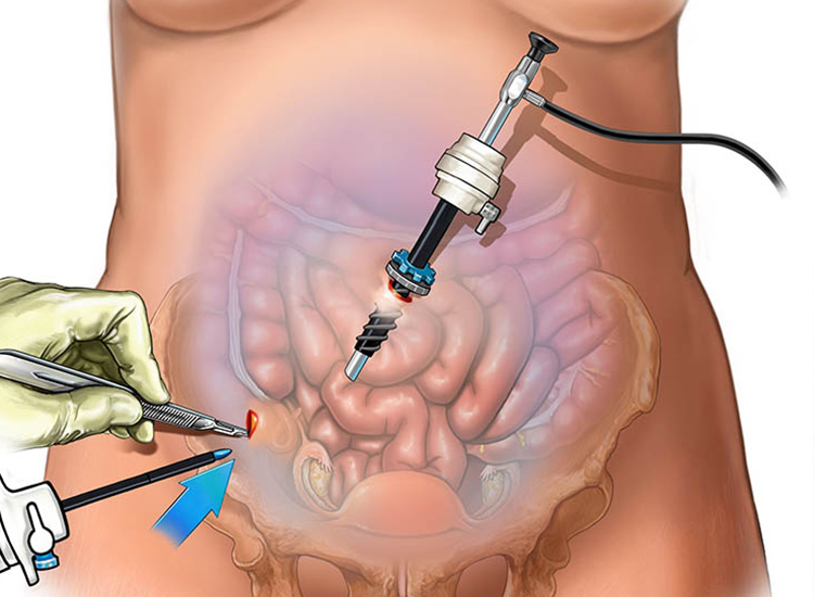 Serivce Image